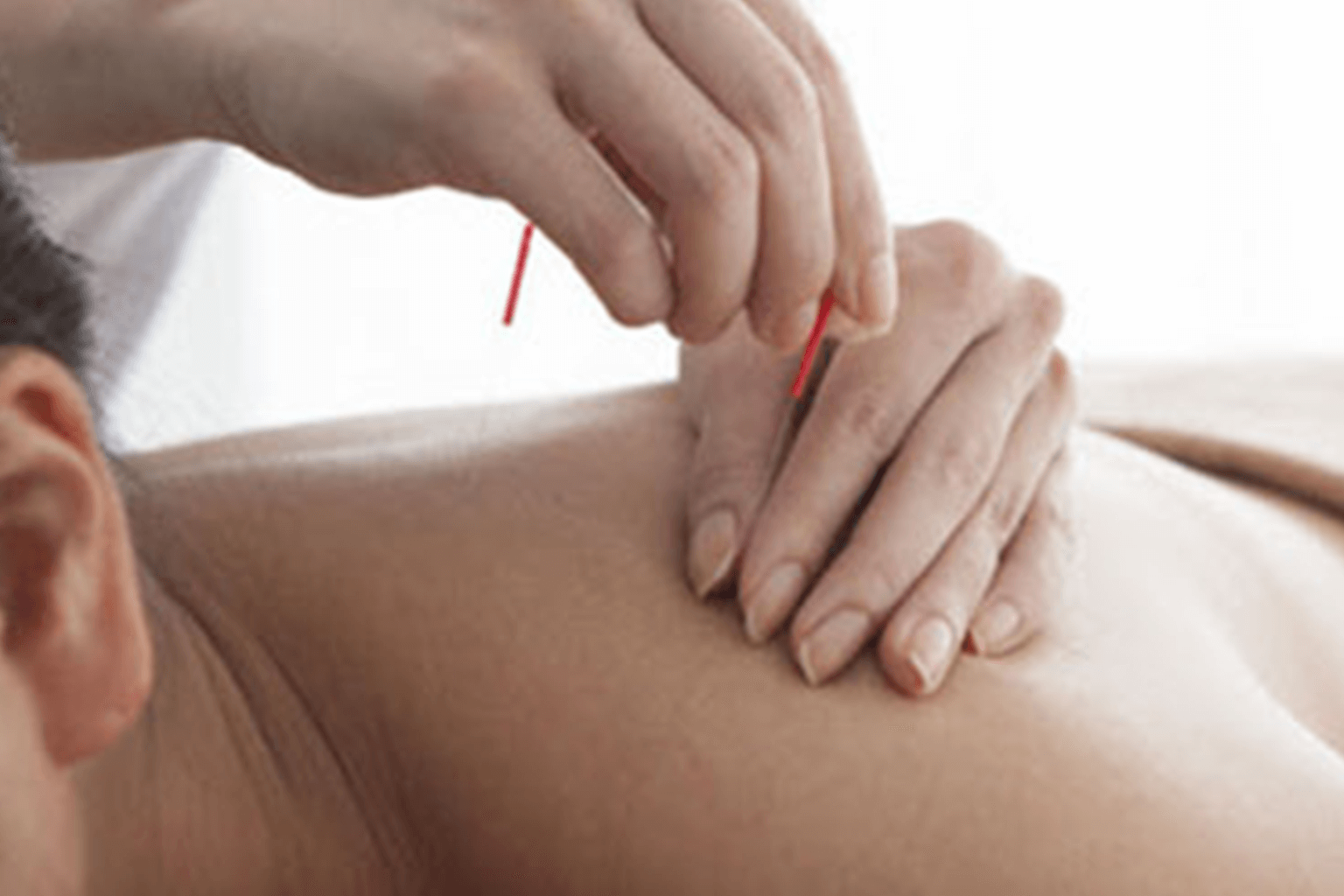 Clinical Acupuncture Toronto | Massage Therapy – Restoracare Health