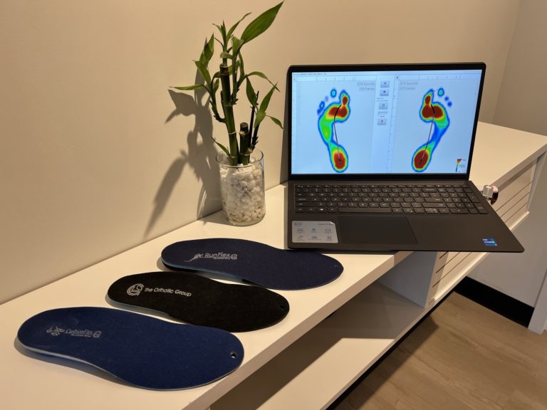 custom orthotics, flat feet pain