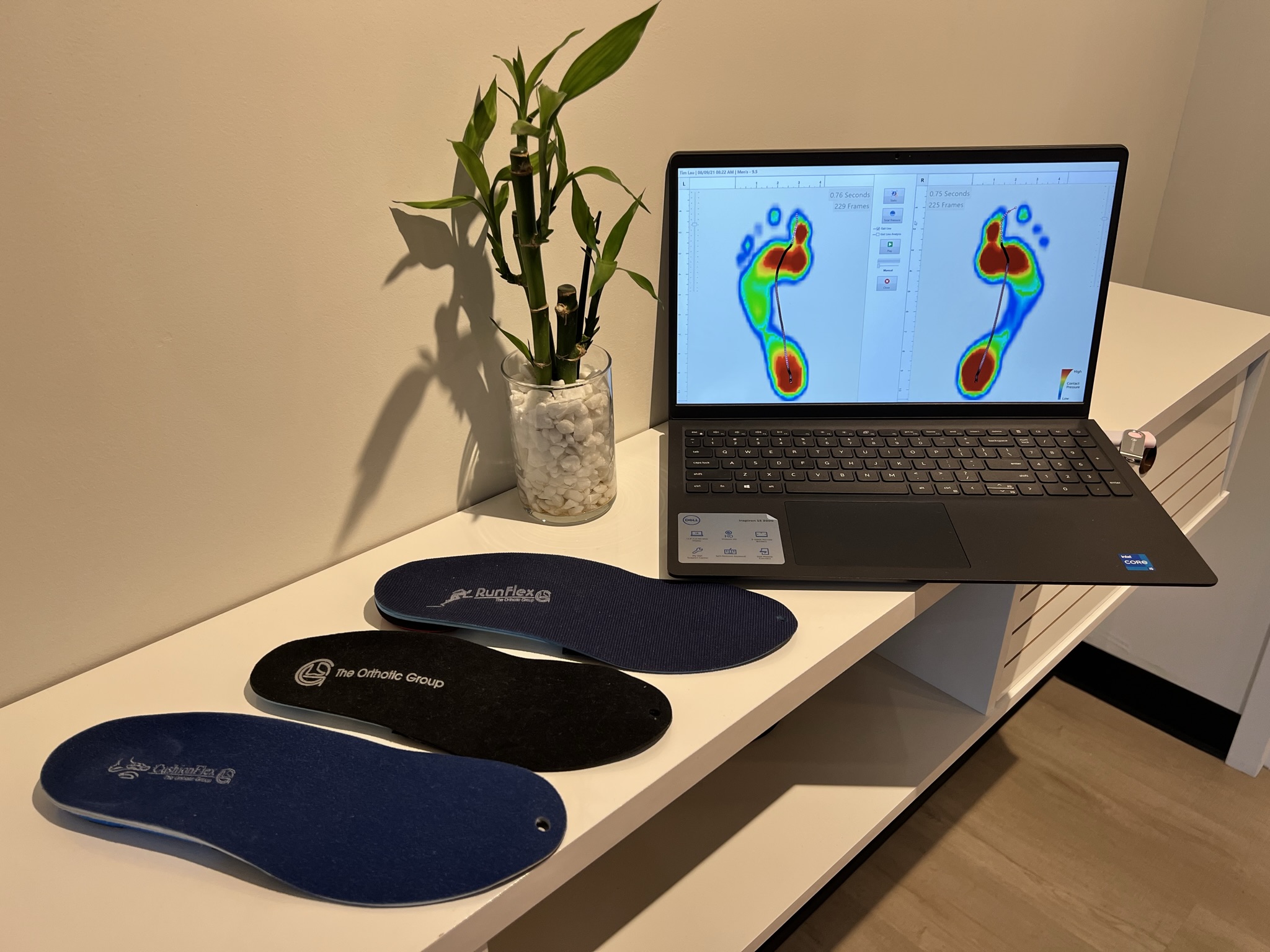 How Custom Orthotics Can Reduce Flat Feet Pain and Enhance Your Daily Mobility