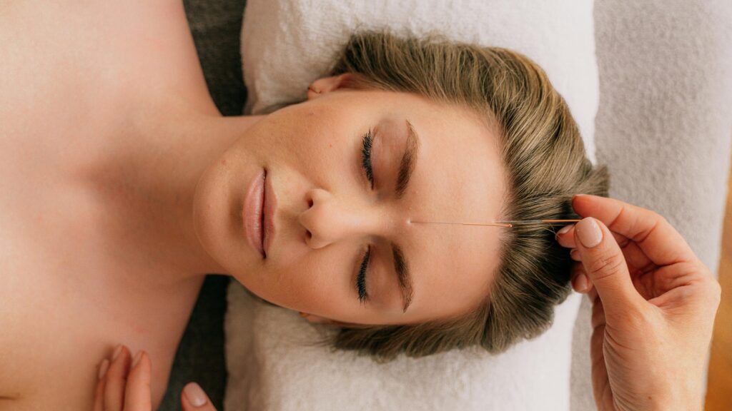 facial acupuncture, cosmetic acupuncture