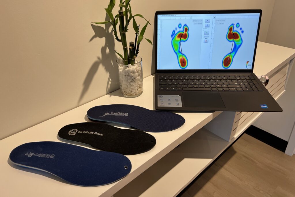 Plantar Fasciitis, Physiotherapy for Plantar Fasciitis Pain, Plantar Fasciitis Pain, custom orthotics