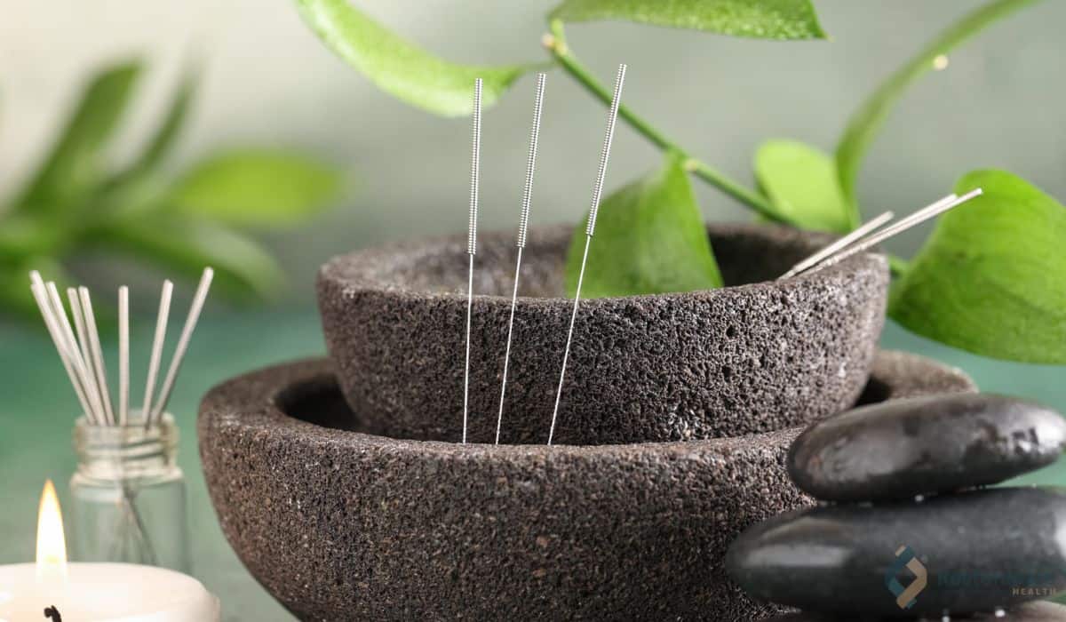 Natural Glow_ Is Cosmetic Acupuncture Worth It_