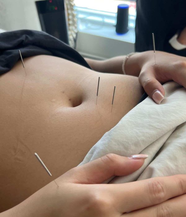 Resoracarehealth Acupunture with Kate